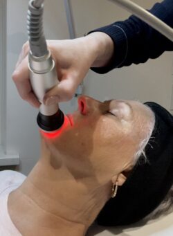 Skin Tightening Treatment